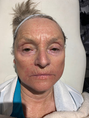 Anne 70+ amazing results