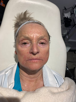 Anne 70+ amazing results